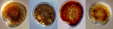Views of 4 Gambierdiscus species viewed under a microscope